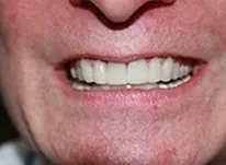 Dental Smiles