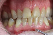 Dental Services Before