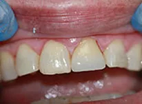 Dental Example